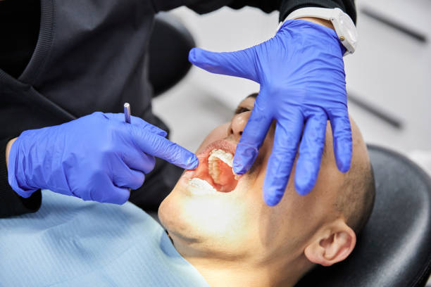 Best Emergency Dentist for Knocked-Out Tooth in Abbeville, GA