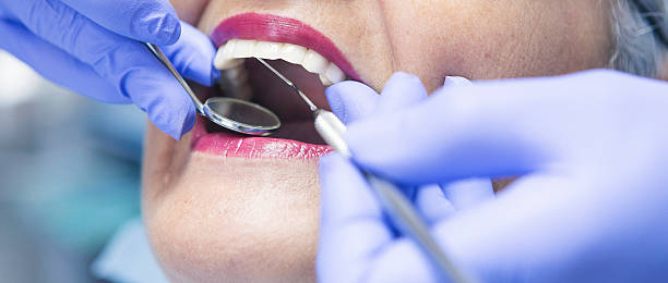 Best Emergency Dental Care for Abscessed Tooth in Abbeville, GA